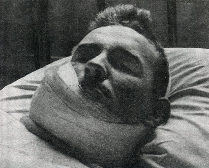 William Joyce se recupera de su herida en la cara por una cuchilla de afeitar